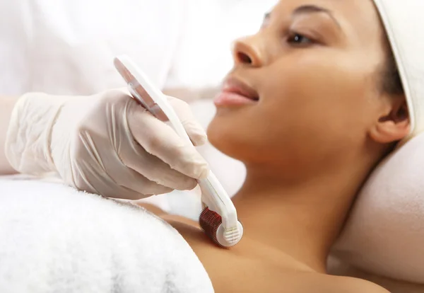 Roller ,microneedle mesotherapy, rejuvenating treatment — Stock Photo, Image