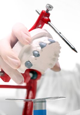Meslek prosthetist