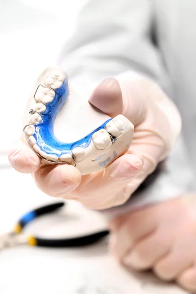 Correctie van malocclusie, orthodontie — Stockfoto