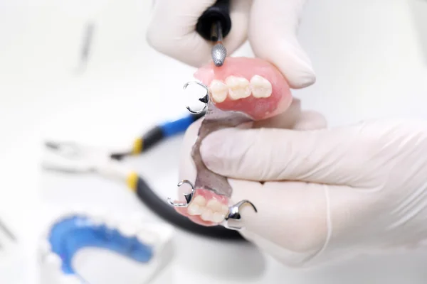 Partial dentures on a metal arc — Stock Photo, Image