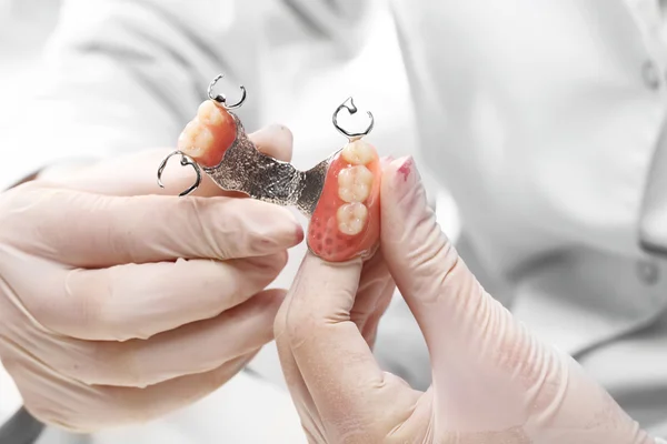 Veneers, dentures, bridges - prosthetist at work — Stock Photo, Image