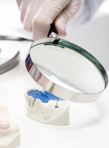 Prosthetics hands while working on orthodontic appliance — Stock Photo, Image