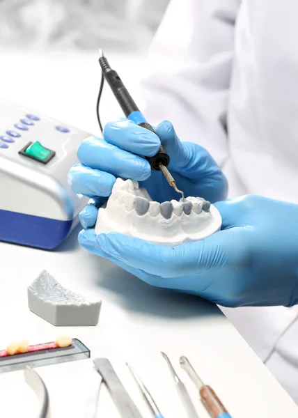 Dental, uma prótese dentária polidores — Fotografia de Stock