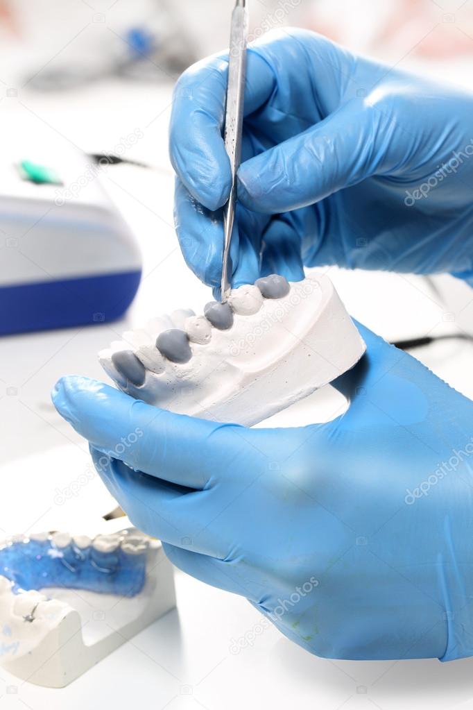 Partial dentures, dental and prosthetics