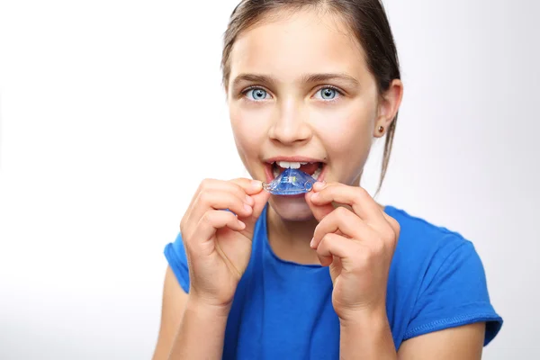 Colored dental braces . — Stock Photo, Image