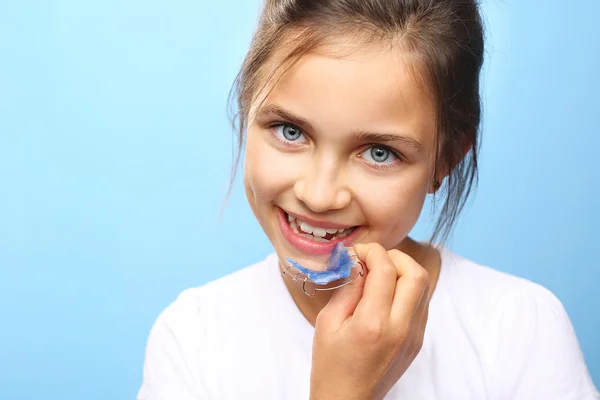 Orthodontics. — Stock Photo, Image