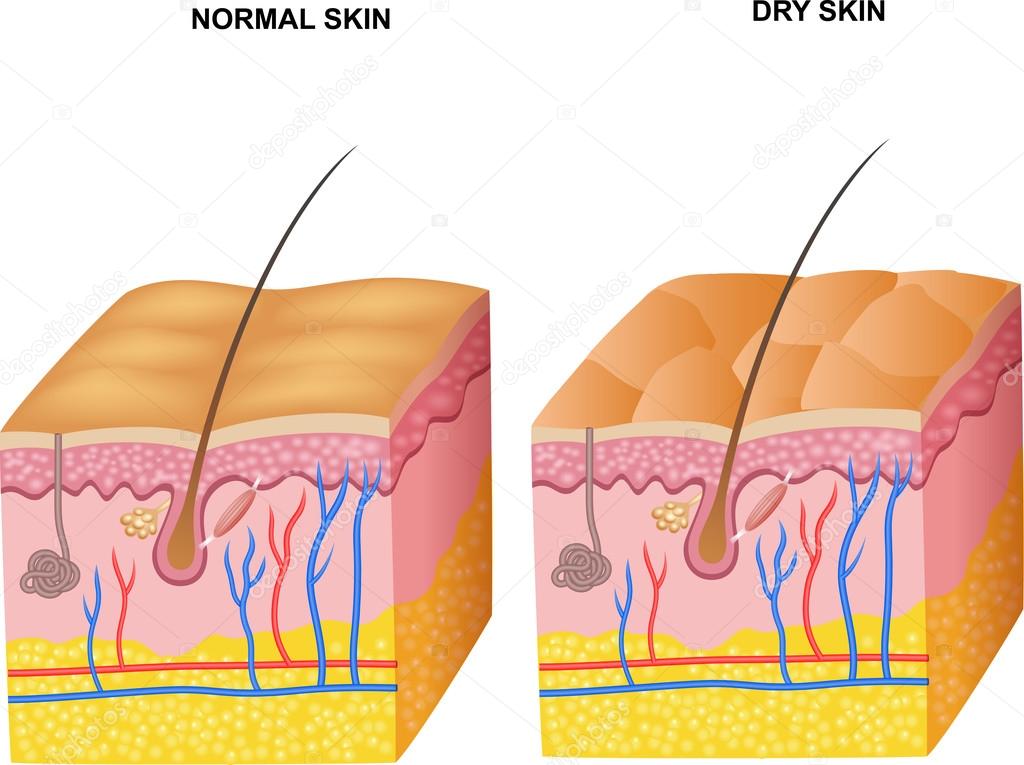 Illustration of The layers normal skin and dry skin