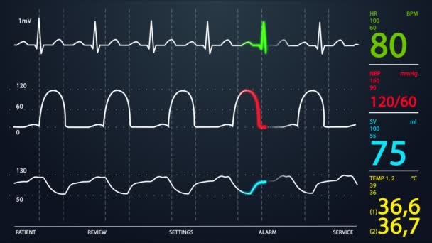 Intensive care afdeling monitor — Stockvideo