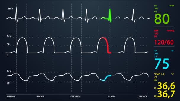 Monitor de unidade de terapia intensiva — Vídeo de Stock