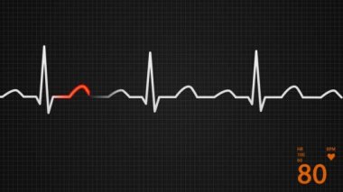 Kalp hızı diyagramı.