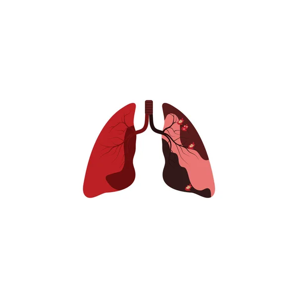 Logotipo Pulmonar Plantilla Vector Símbolo Naturaleza — Vector de stock