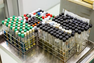 Kirli laboratuvar test tüpleri raflar içinde