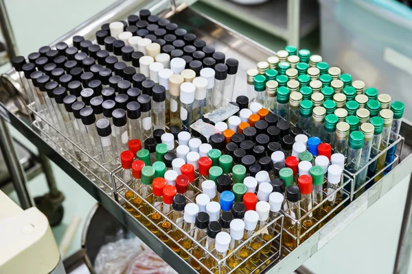 Dirty laboratory test tubes in racks — Stock Photo, Image