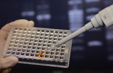 Dna testi laboratuvarda. 