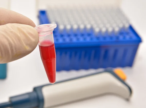 Анализ крови в клинических диагностических лабораториях . — стоковое фото