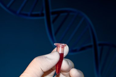 Kan DNA testi.