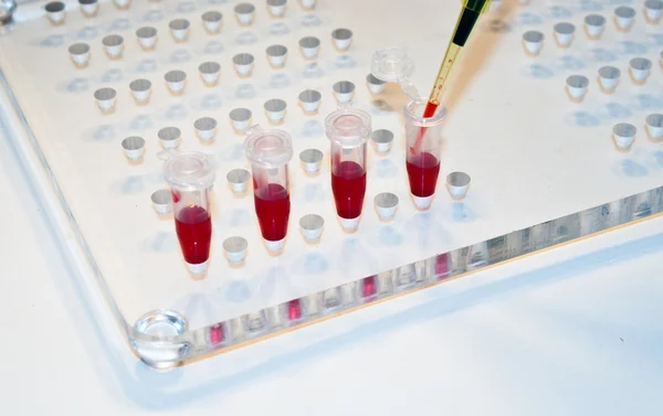 In medical laboratories studied blood. — Stock Photo, Image