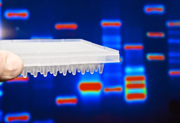 Os testes de ADN . — Fotografia de Stock