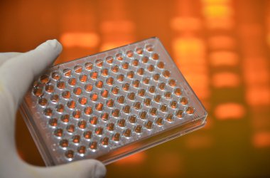 Dna genetik laboratuvarlarda test. 