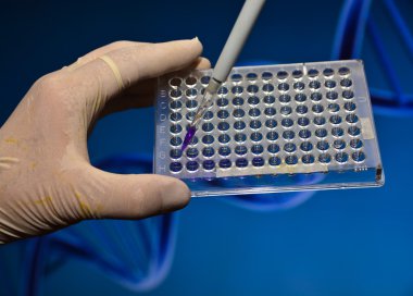 Dna bilimsel bir laboratuvar testi.