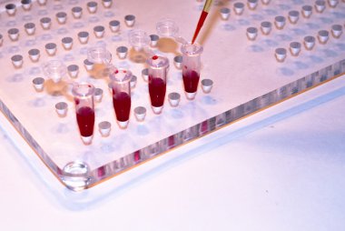 Tıbbi laboratuvarlarda kan okudu.