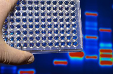 Laboratuvarda iyi plaka.