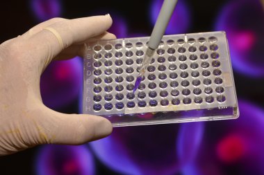 Tıbbi bilim laboratuvar testlerinde. 