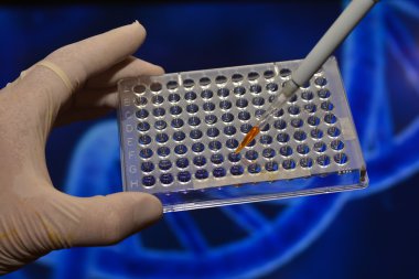 Tıbbi bilim laboratuvar testlerinde. 