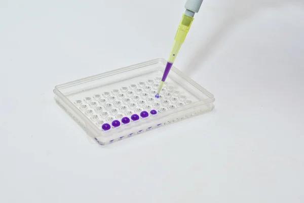 In clinical diagnostic laboratories. — Stock Photo, Image