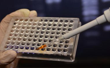 Dna genetik laboratuvarlarda test. 