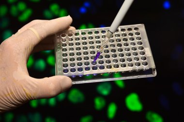 Dna genetik laboratuvarlarda test. 