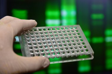 Tıbbi bilim laboratuvar testlerinde. 