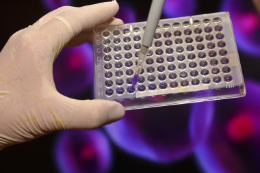 Tıbbi bilim laboratuvar testlerinde. 