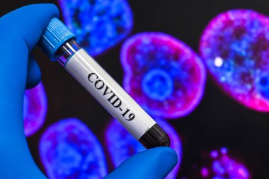 Coronavirus araştırması. COVID-19 'un sebebi olan virüsün laboratuvar incelemesi..