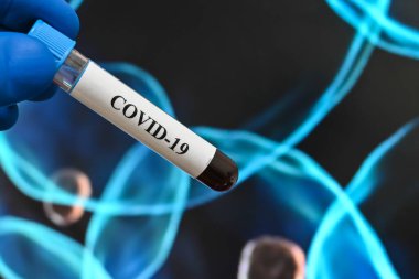 Coronavirus araştırması. COVID-19 'un sebebi olan virüsün laboratuvar incelemesi..
