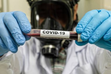 Coronavirus testi. Bir kan örneğinde COVID-19 için antikorların tespiti.