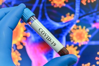 Coronavirus testi. Bir kan örneğinde COVID-19 için antikorların tespiti.