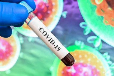 Coronavirus testi. Bir kan örneğinde COVID-19 için antikorların tespiti.