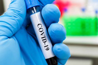 Koronavirüste antikorların tespiti. COVID-19 'dan sonra immünoglobülin testi.