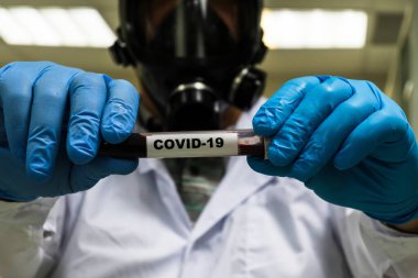 COVID-19 araştırması. Koronavirüs için biyolojik bir örnek test ediliyor..