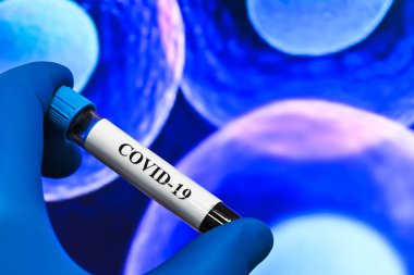 COVID-19 araştırması. Koronavirüs için biyolojik bir örnek test ediliyor..