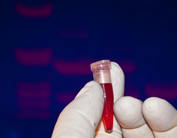 Анализ крови в лаборатории . — стоковое фото