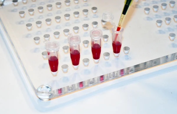 In medical laboratories studied blood. — Stock Photo, Image