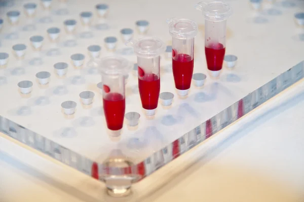 In medical laboratories studied blood. — Stock Photo, Image