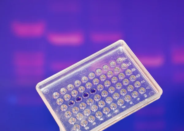 Testen in het laboratorium van DNA. — Stockfoto