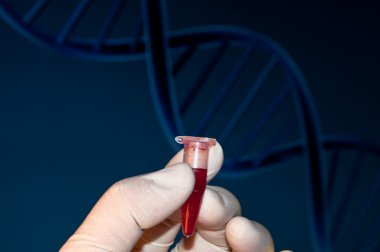 Kan DNA testi.