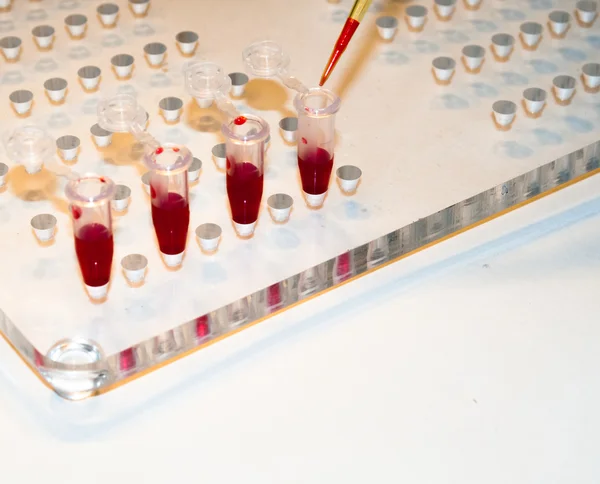 En laboratorios médicos estudiados sangre . —  Fotos de Stock
