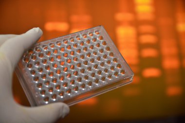 Dna testi. 