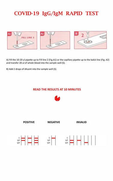 Covid Igg Igm Rapid Test Instruction Sars Cov2 Serological Test — Stock Photo, Image