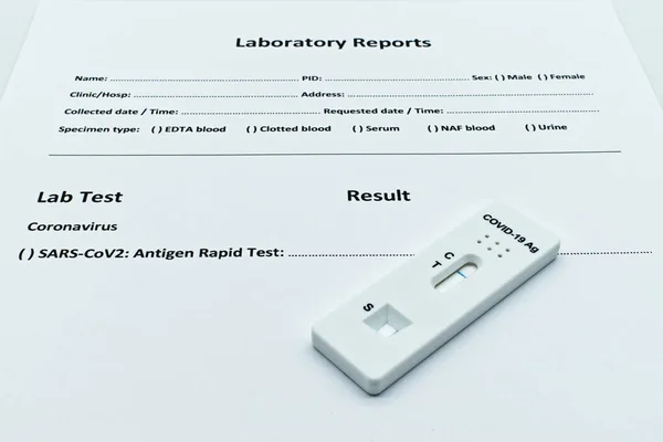 Covid Antigen Rapid Test Device Laboratory Report Module Isolated White — Stock Photo, Image